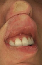 mouth 2